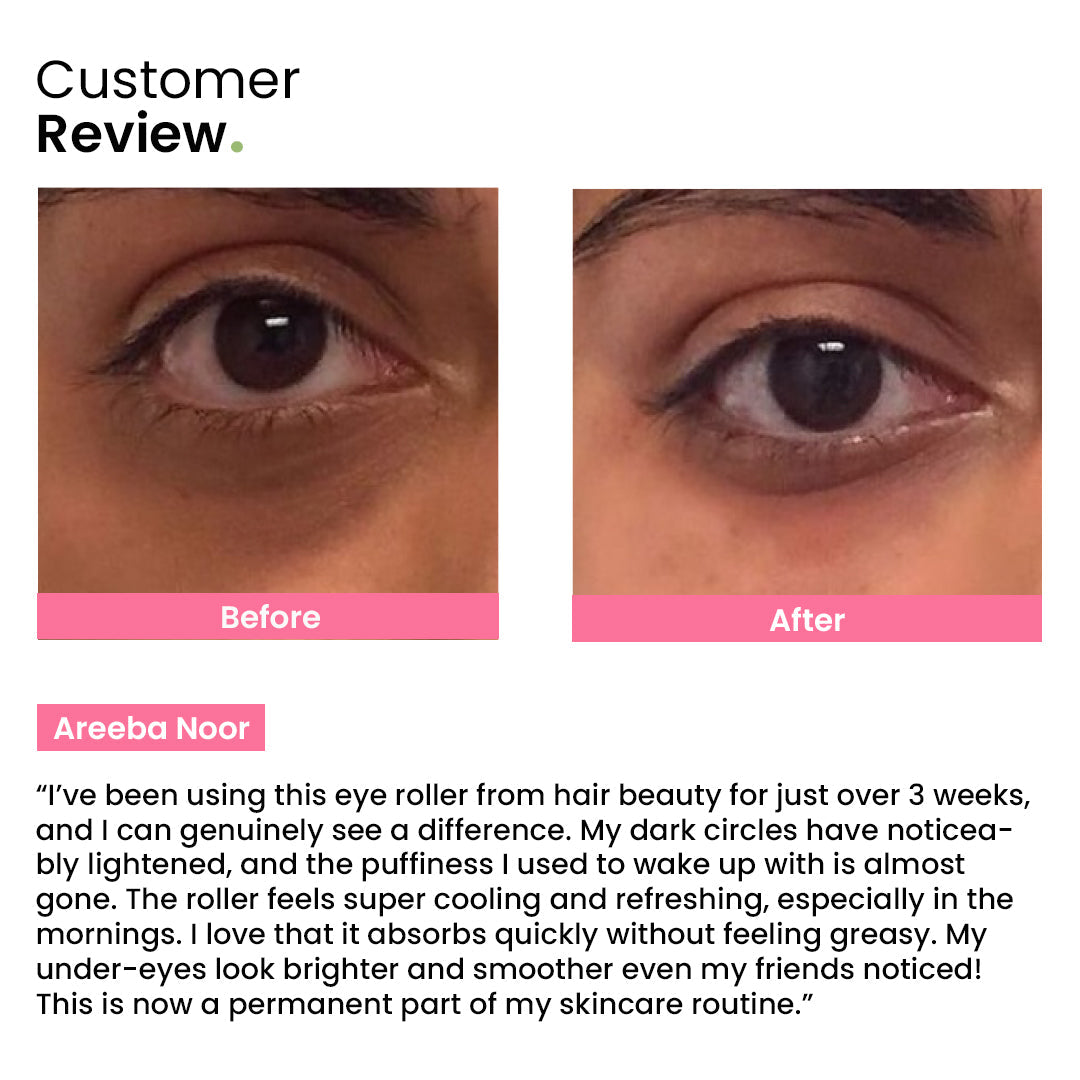 Hair Beauty Eye Roller | Eliminates Dark Circles & Puffy Eyes
