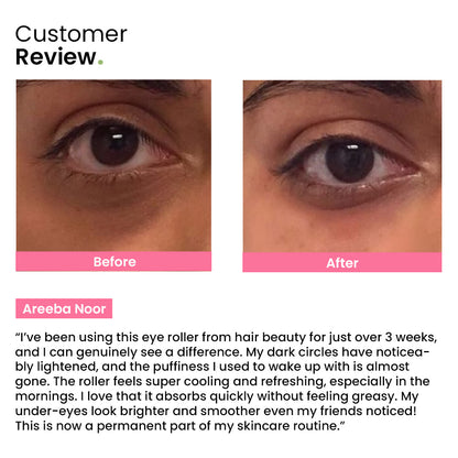 Hair Beauty Eye Roller | Eliminates Dark Circles & Puffy Eyes