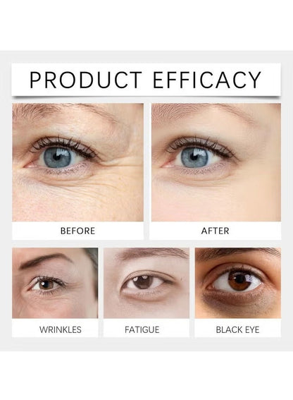 Hair Beauty Eye Roller | Eliminates Dark Circles & Puffy Eyes