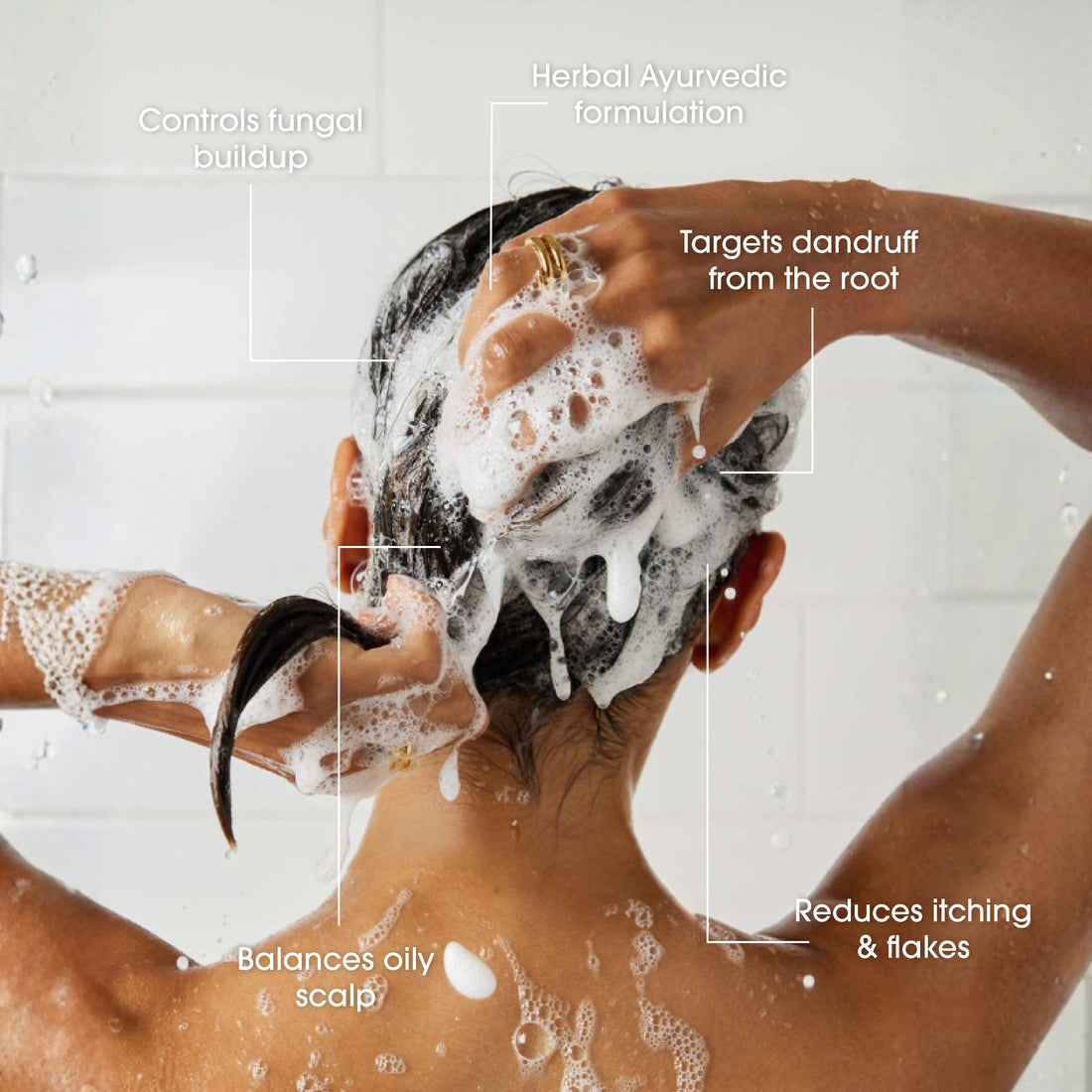 Niconi Anti-Dandruff Shampoo For Men And Women BUY 1 GET 1 FREE